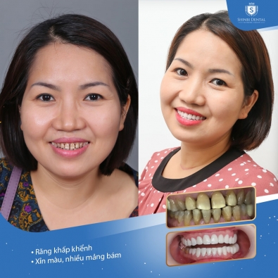 Khách hàng Thúy Hằng